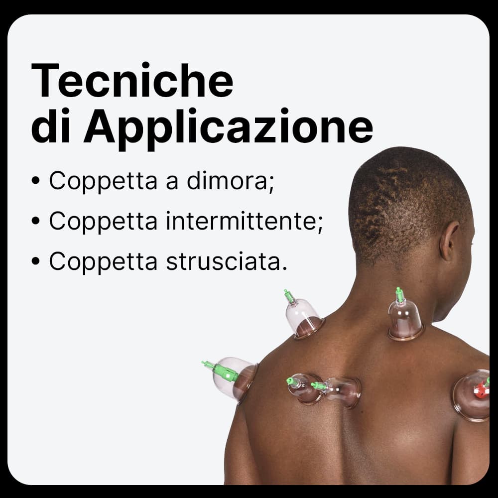 Tecniche-applicative-Coppettazione