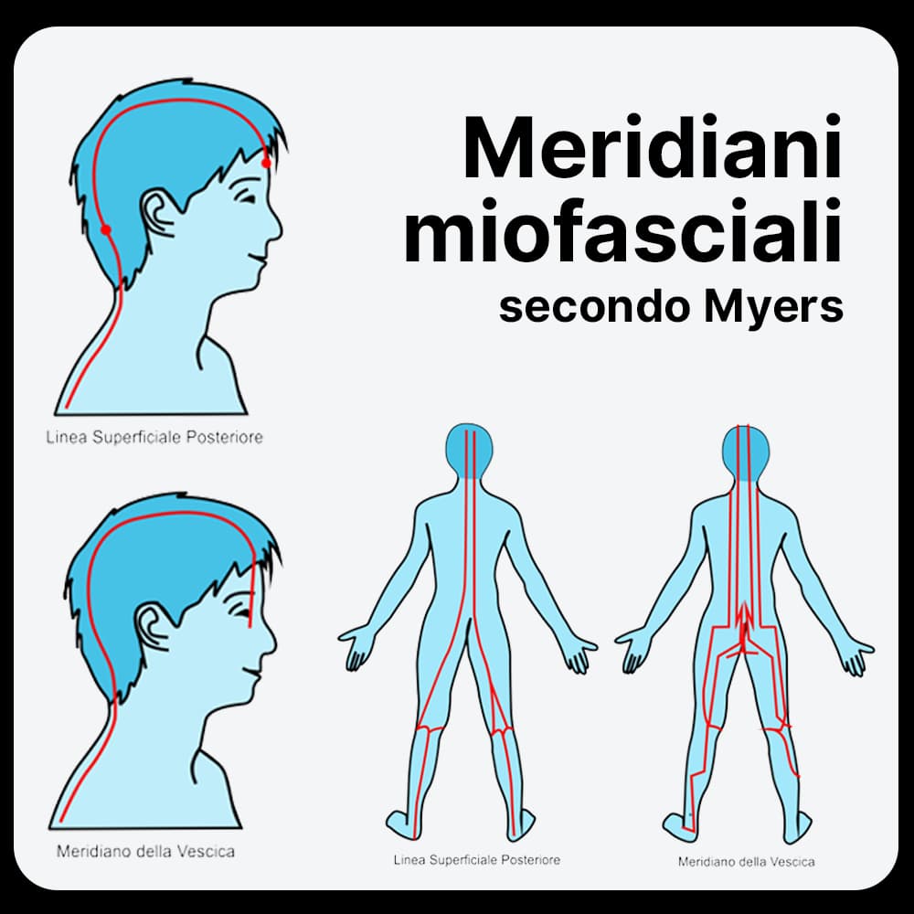 Meridiani-miofasciali-video-corso-Coppettazione