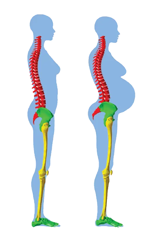 Modificazioni posturali in gravidanza