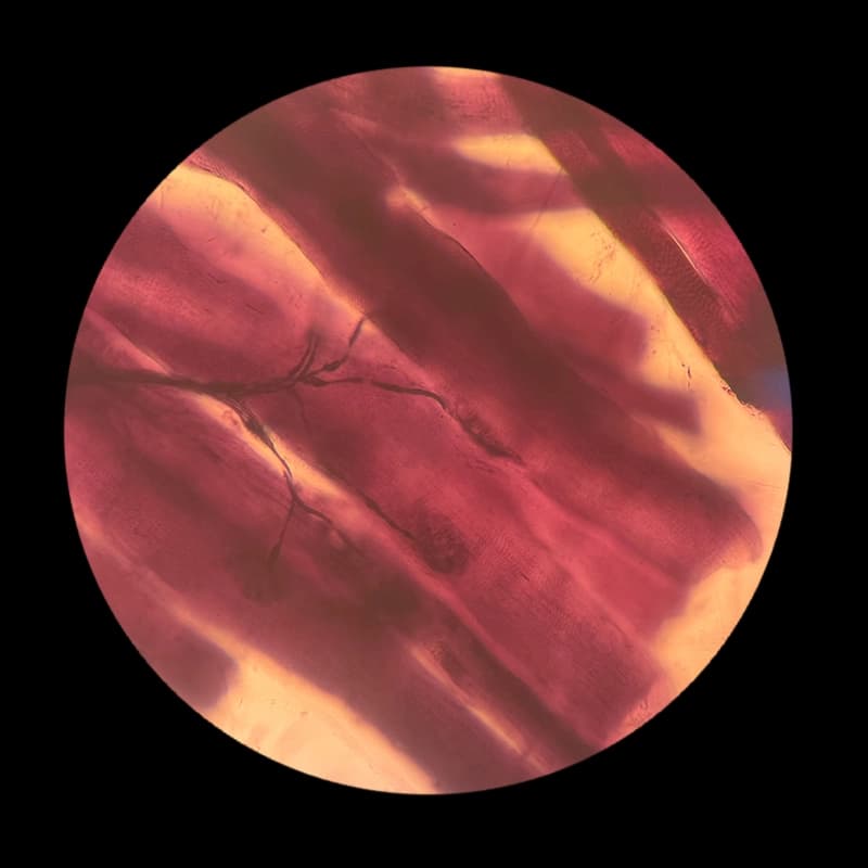 Ipertrofia-Sarcoplasmatica-Miofibrillare-ATS